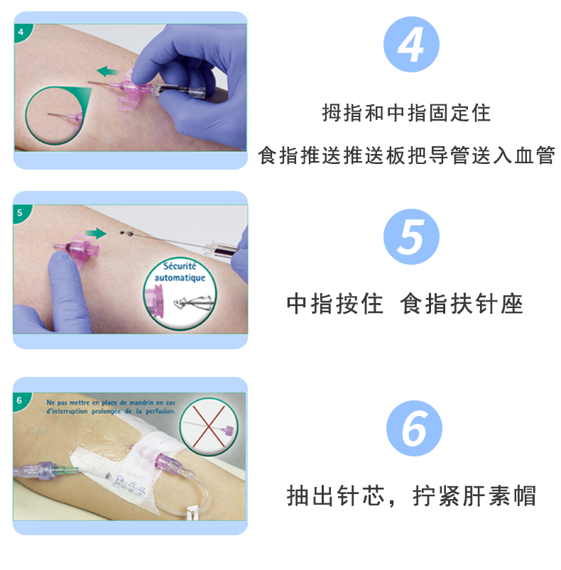 德國貝朗Introcan Safety-W 英全康18G 安全型 帶翼動靜脈留置針